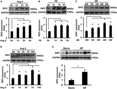 Cardiomyocyte-Specific RIP2 Overexpression Exacerbated Pathologic Remodeling and Contributed to Spontaneous Cardiac Hypertrophy